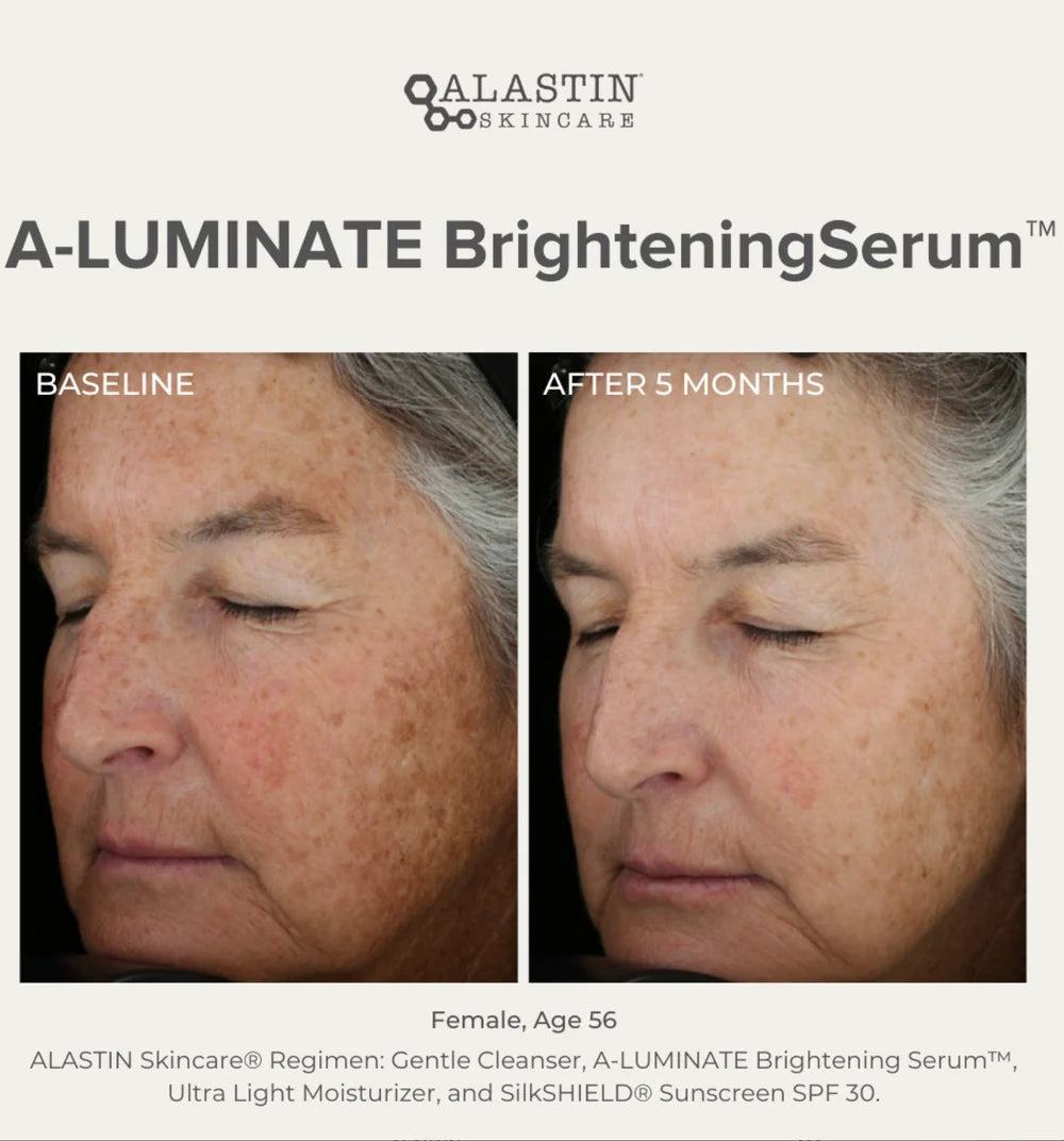 Alastin A-Luminate Brightening Serum®
