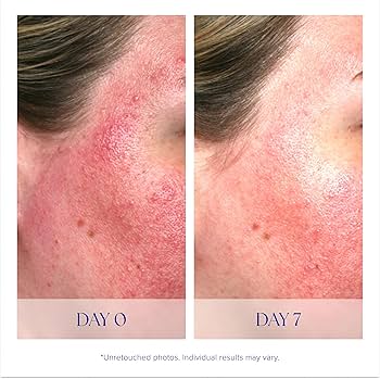 IS Clinical • Pro-Heal Serum Advance+
