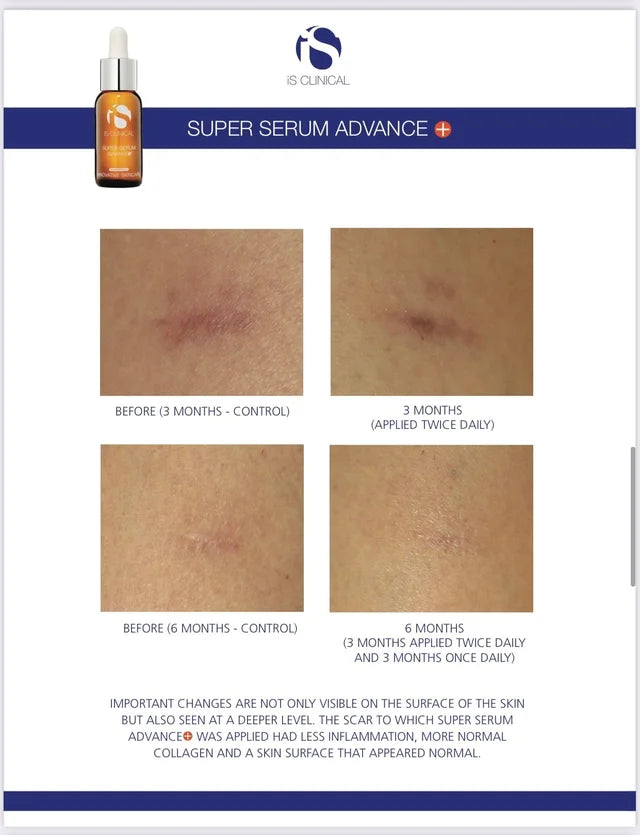 IS Clinical • Super Serum Advance+